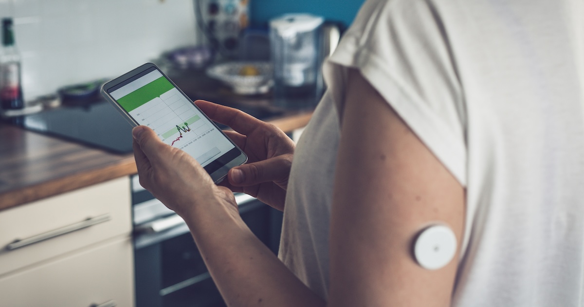 Person wearing CGM patch tracks data on mobile app Person wearing CGM patch tracks data on mobile app