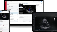 
  Tricog's InstaEcho app on various devices
