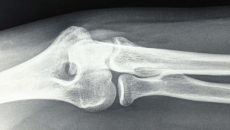 
  X-ray image
