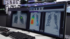 
  Two computer units showing the Lunit INSIGHT CXR
