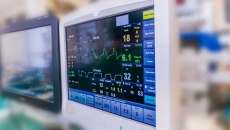 A surgery monitor showing heart data