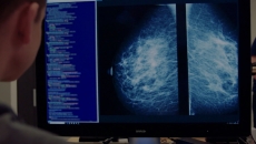 Kheiron Medical Technologies, Atlas Medical, AI, WHO, cancer diagnostics, machine learning
