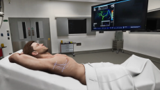 A rendered image of a person lying on an operating table.