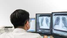 A doctor reading chest x-ray scans.