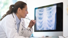 A doctor looking at a chest x-ray