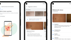 Google dermatology