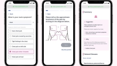 Mobile interface of Ubie's web-based AI Symptom Checker