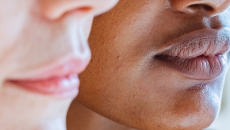 skin health