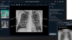 Mobile and desktop versions of Qure.ai's chest X-ray analysis solution