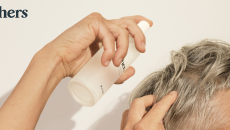 Hers female hair lloss