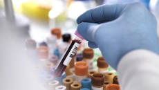 A close up of a lab worker holding a tube of blood