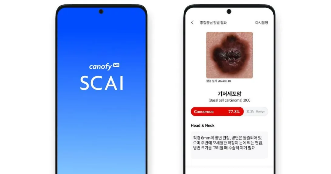 Mobile interface of LifeSemantics' canofyMD SCAI Mobile interface of LifeSemantics' canofyMD SCAI