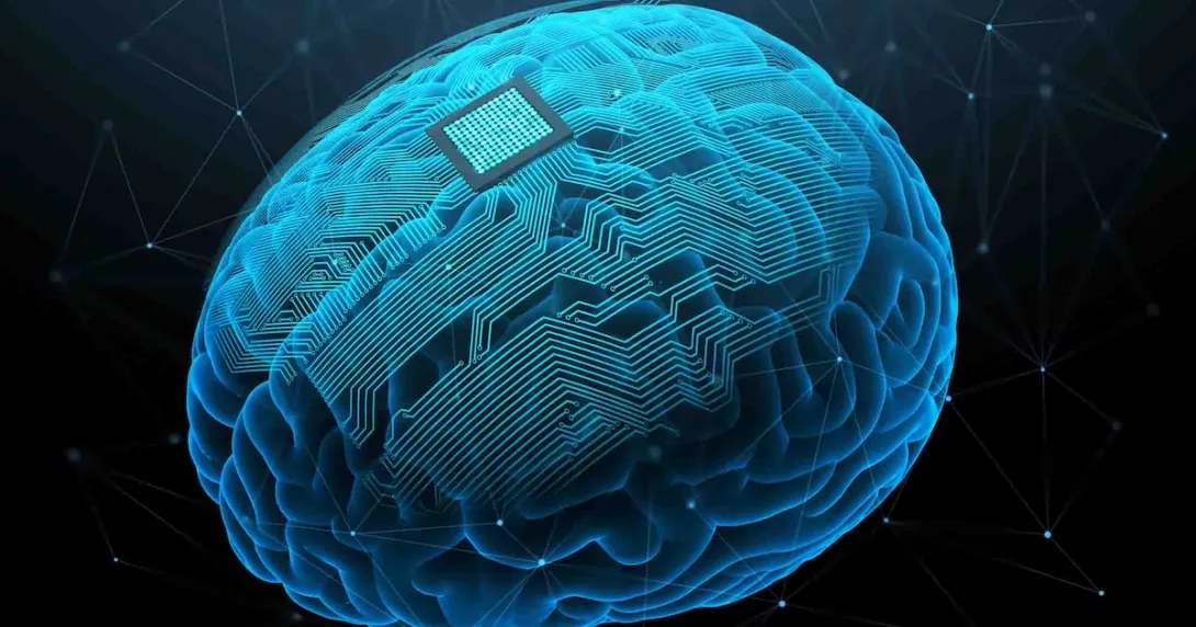AI illustration of a brain with an implant AI illustration of a brain with an implant