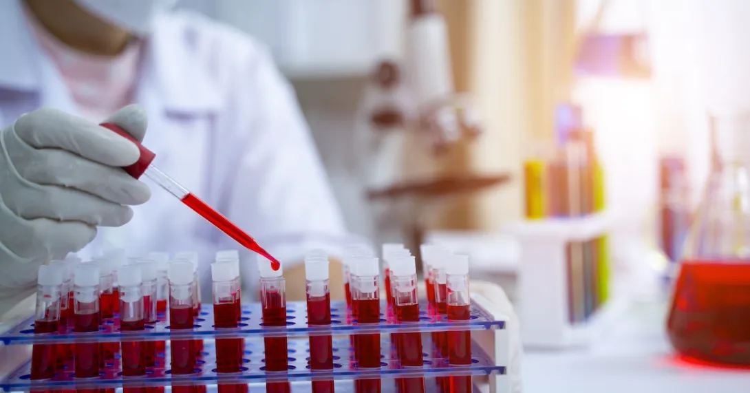 Laboratory worker working with blood tests Laboratory worker working with blood tests