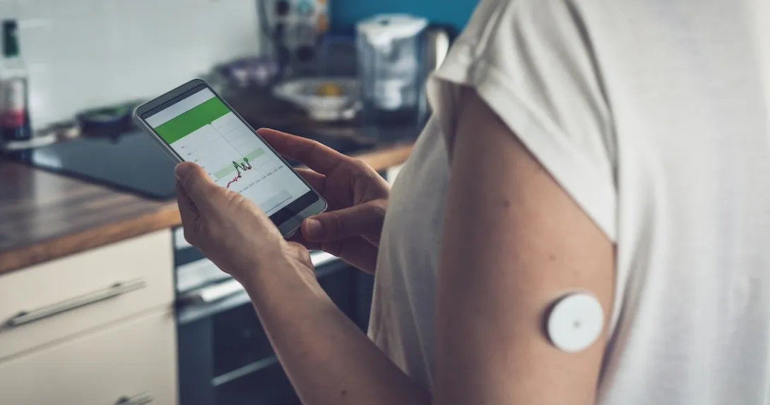 Patient with wearable glucose monitoring device looking at smart phone Patient with wearable glucose monitoring device looking at smart phone