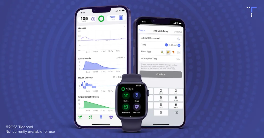 Tidepool Loop application on a phone
Tidepool Loop application on a phone
