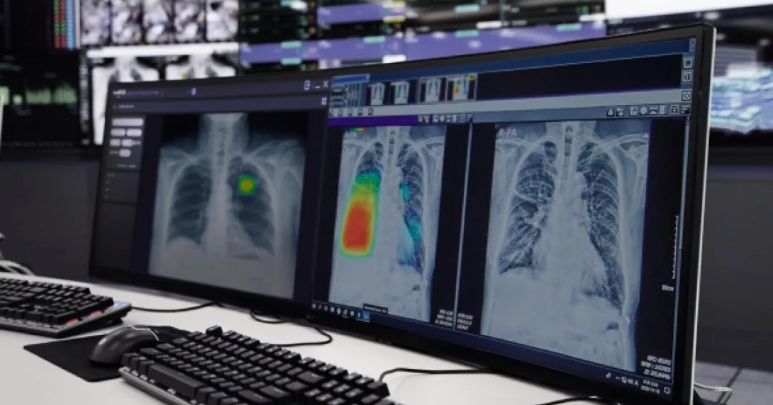 Two computer units showing the Lunit INSIGHT CXR