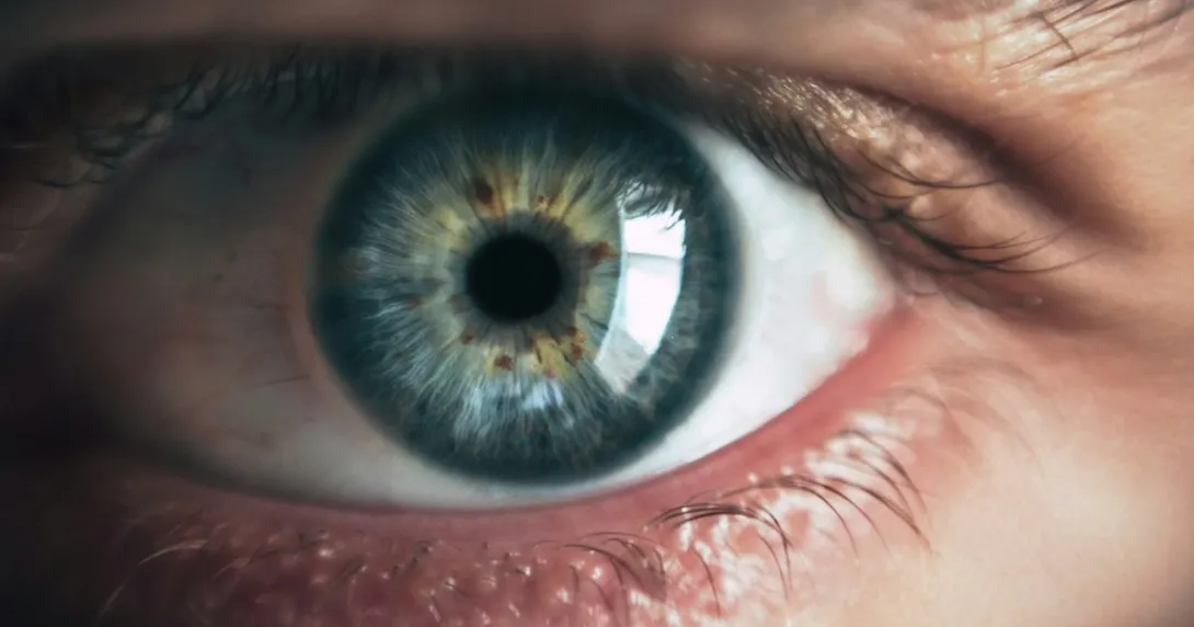 Photo of an eye Photo of an eye