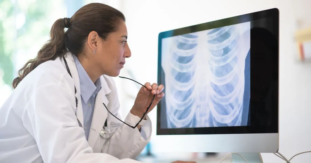 Healthcare professional looking at a computer screen with an x-ray on it Healthcare professional looking at a computer screen with an x-ray on it