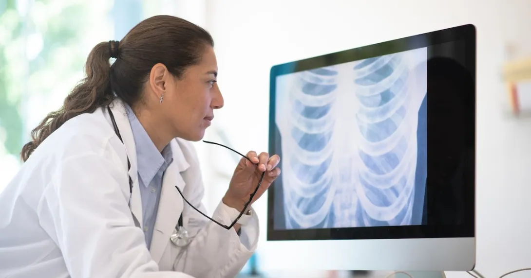 A doctor assessing a chest X-ray scan A doctor assessing a chest X-ray scan