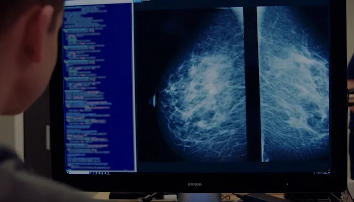 Kheiron Medical Technologies will distribute its Mia, or “mammography intelligent assessment” in the GCC region via a new partnership with Atlas Medical. Kheiron Medical Technologies, Atlas Medical, AI, WHO, cancer diagnostics, machine learning