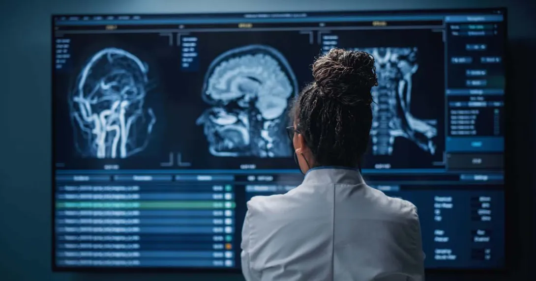 Healthcare provider looking at brain scan images Healthcare provider looking at brain scan images