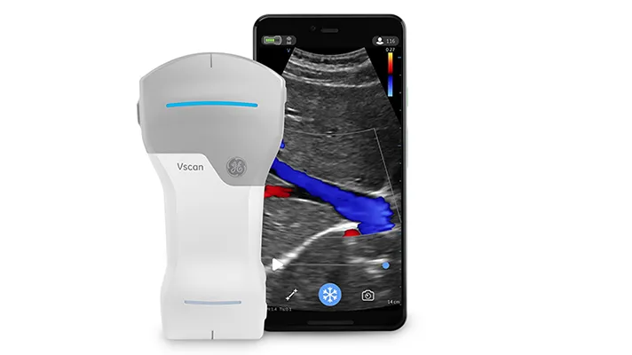 The Vscan Air with its smartphone app