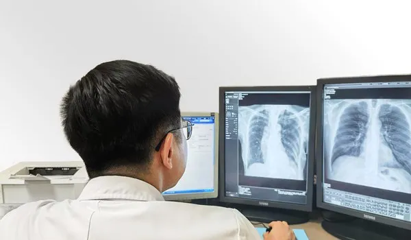 A doctor reading chest x-ray scans.