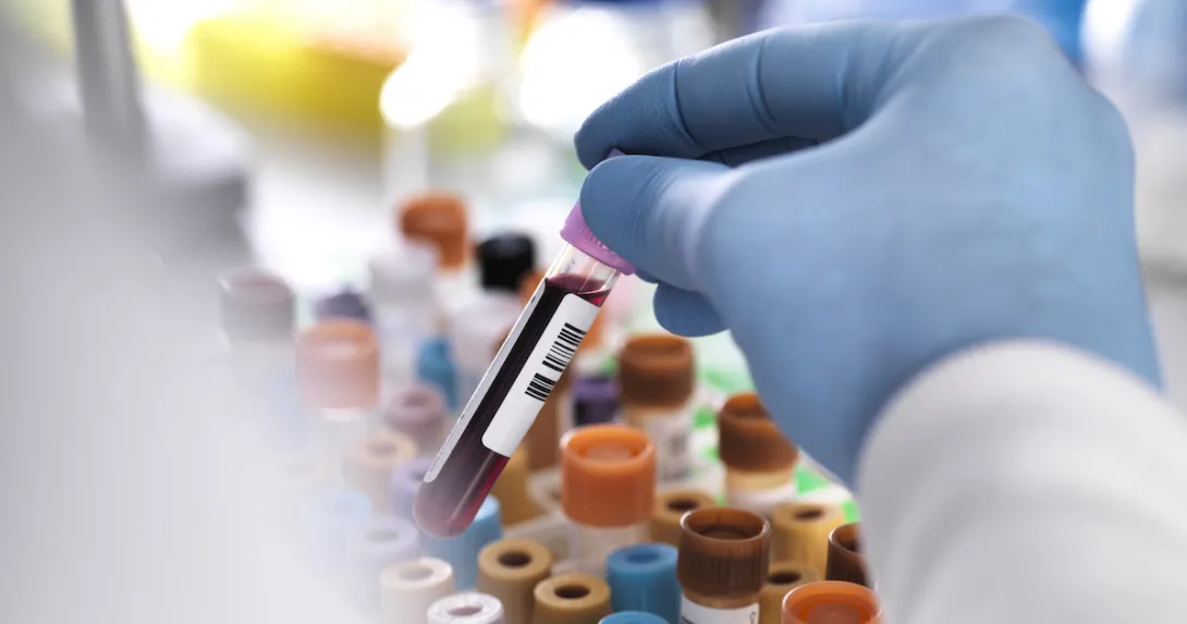 A close up of a lab worker holding a tube of blood A close up of a lab worker holding a tube of blood
