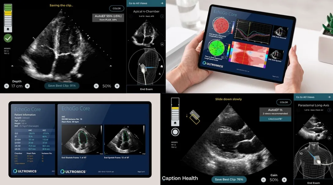 The pair aim to make AI-enhanced diagnostics accessible beyond hospital settings. Ultromics, ultrasound, AI, dianostics, Caption Health
