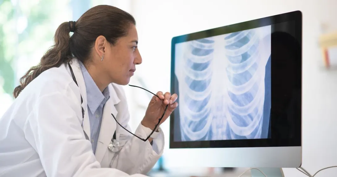 A doctor looking at a chest x-ray A doctor looking at a chest x-ray