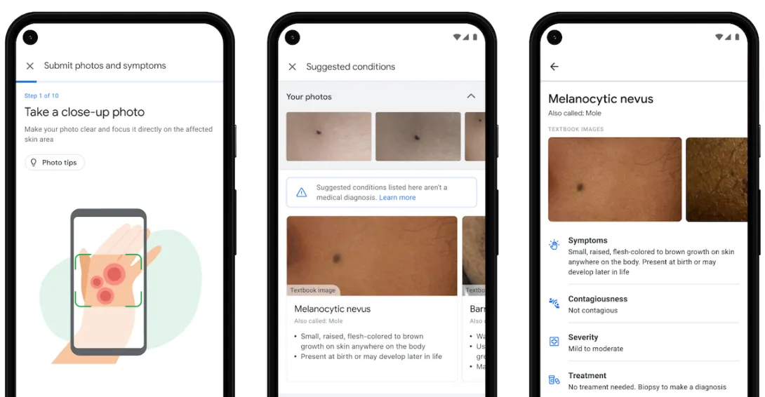 Google dermatology