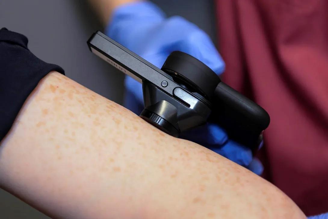 Also, study finds digital physiotherapy app is clinically effective. Moonhub, AI, Ascenti, ELARA, skin cancer, Wellola, NHS