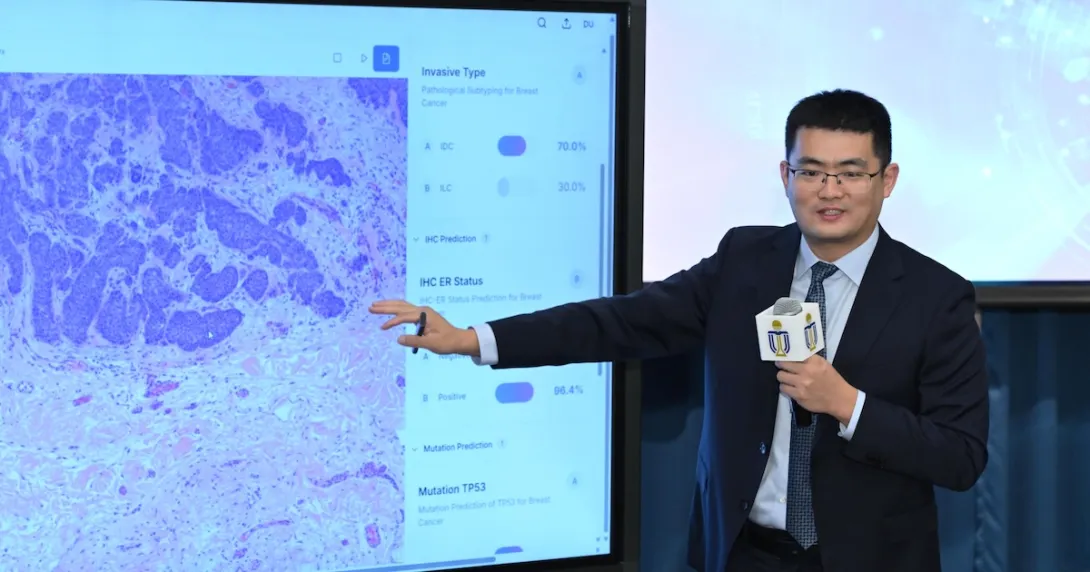  Prof Chen Hao presenting SmartPath, an integrated, AI-driven pathology system 