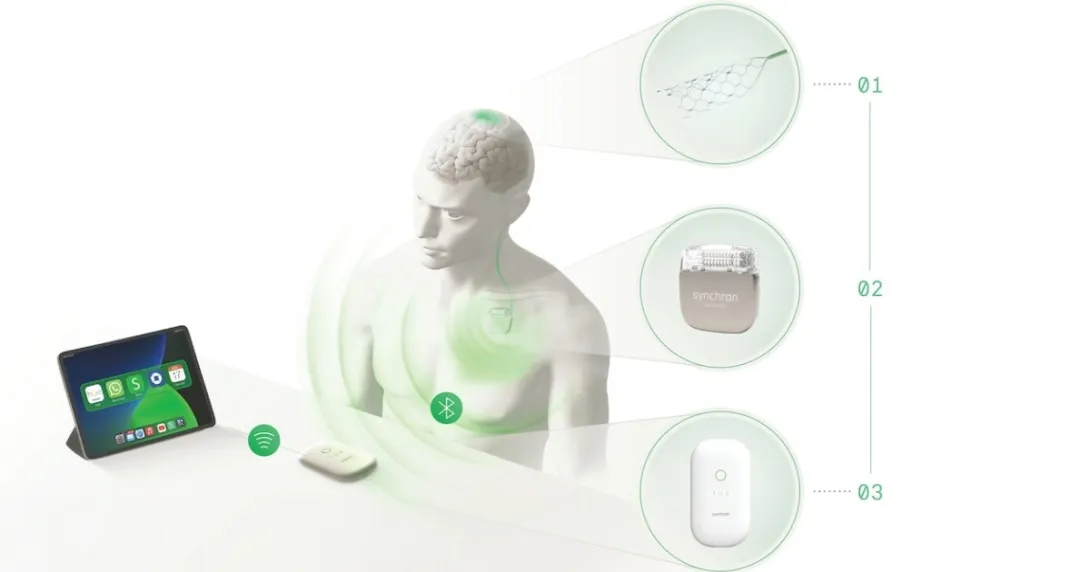 Synchron digital interpretation of its BCI being used with a tablet