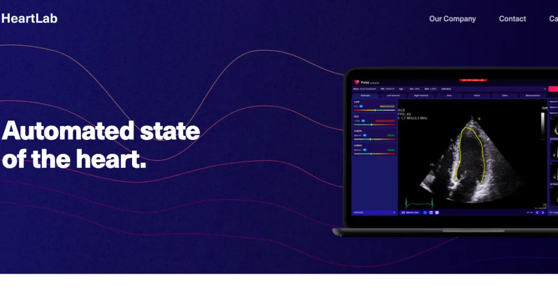 Screenshot of HeartLab website